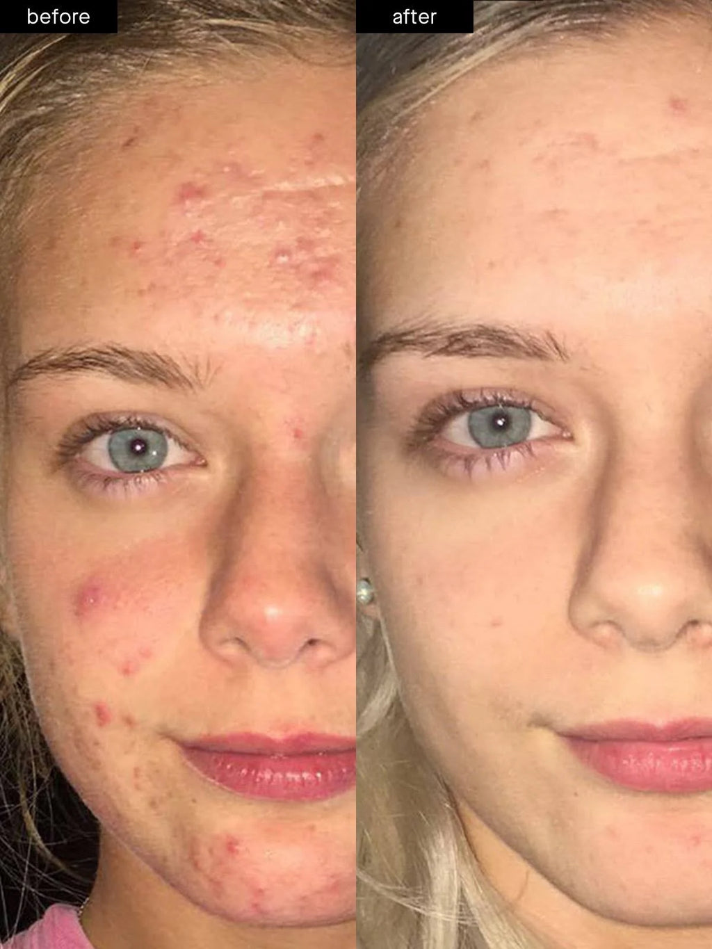 Standard Kit (60-Day) S426